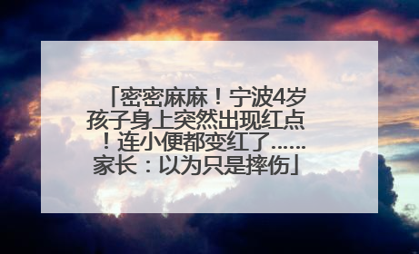 密密麻麻！宁波4岁孩子身上突然出现红点！连小便都变红了……家长：以为只是摔伤